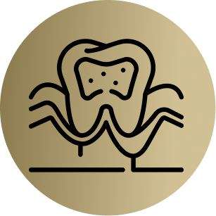 Veneers