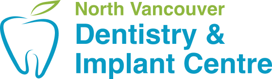 northvancouverdentalimplants