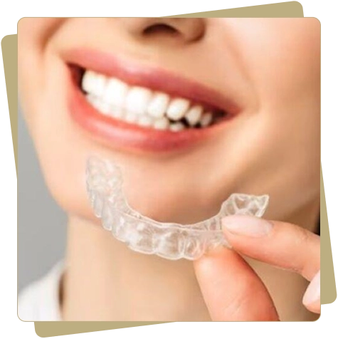 Invisalign Image 1